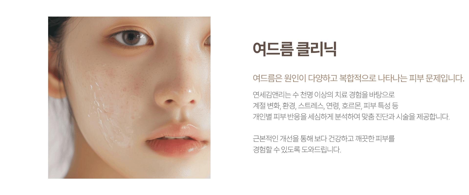 여드름 클리닉 이유