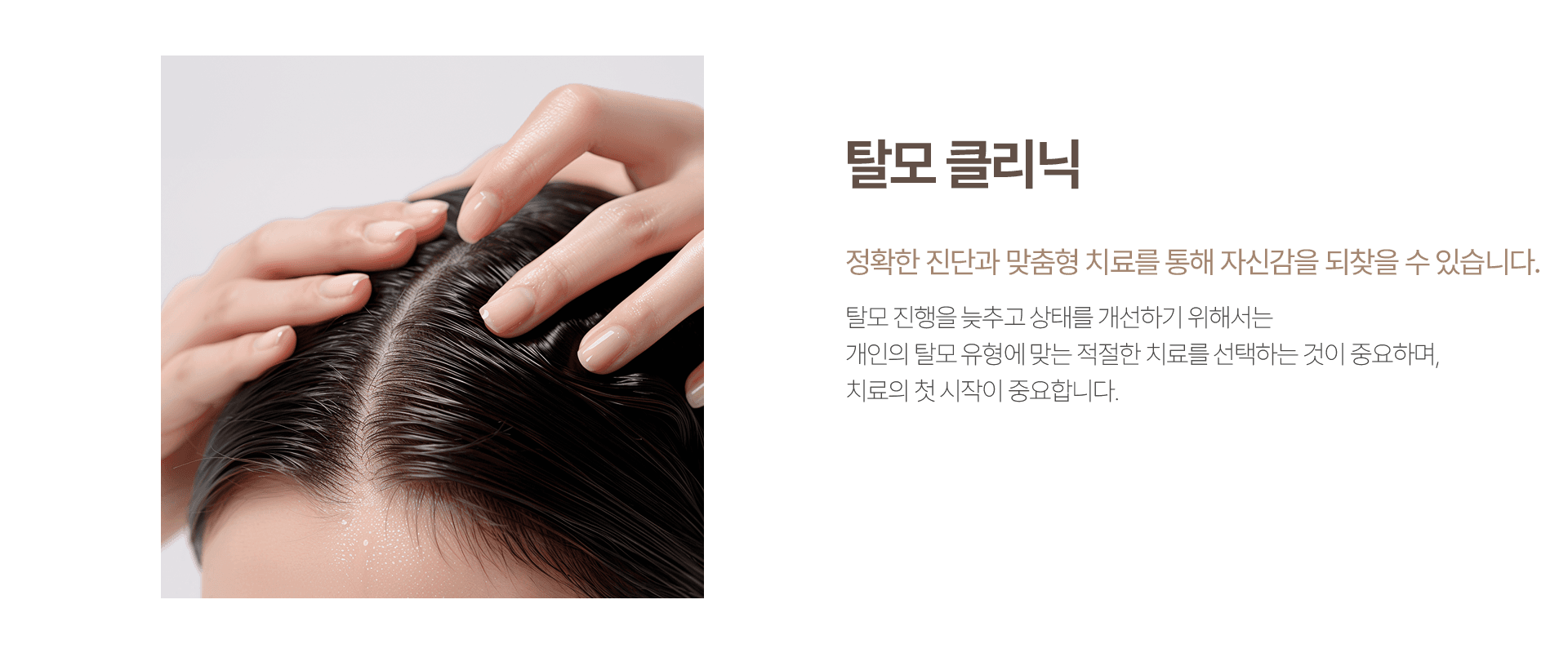 탈모 클리닉 2